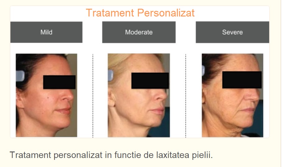 Tratament-personalizat-in-functie-de-laxitatea-pielii