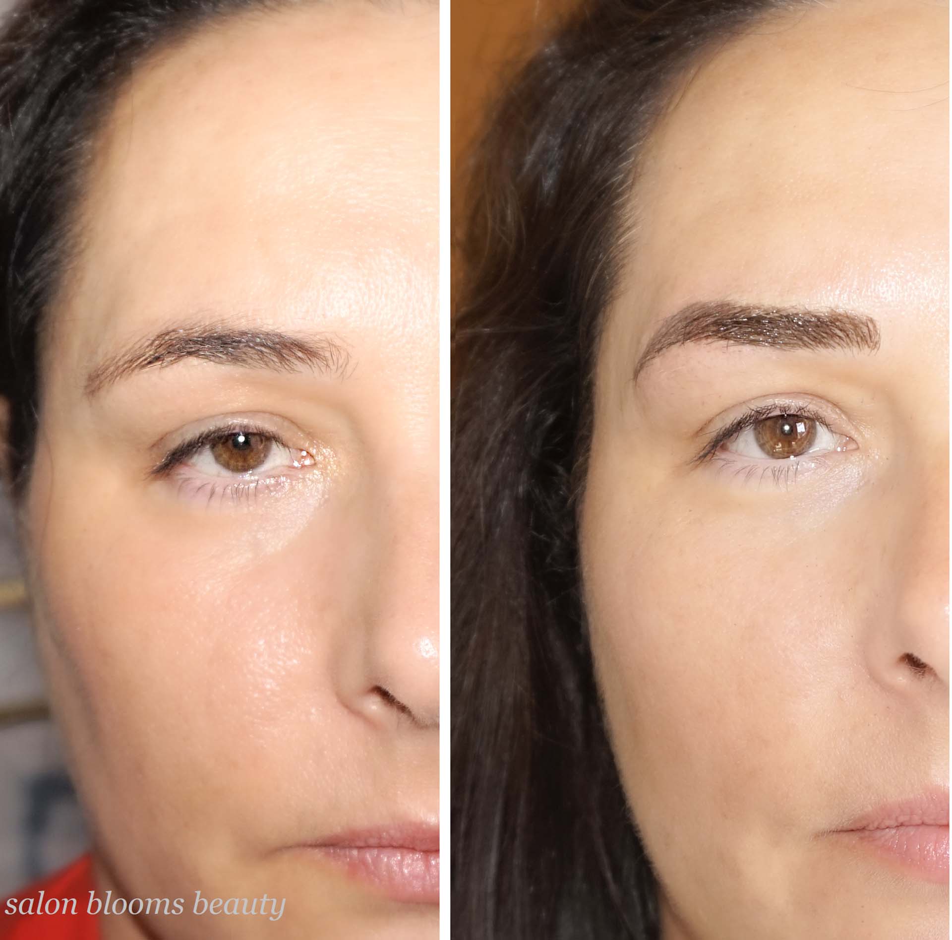 sprancene pigmentate cu o forma groasa